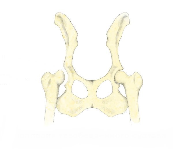 Dysplazia psa hip diagnostika, liečba a prognóza